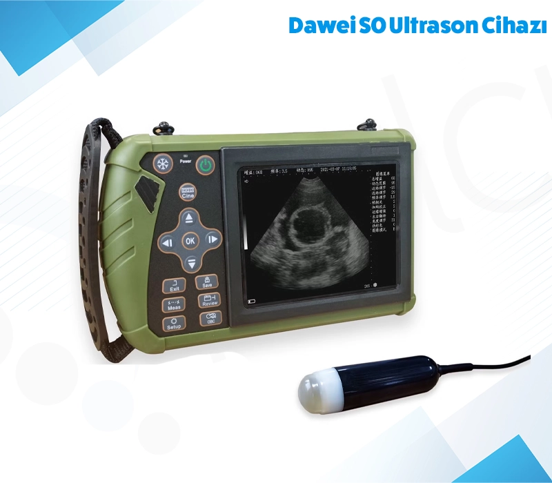 Dawei S0 Ultrason Cihazı