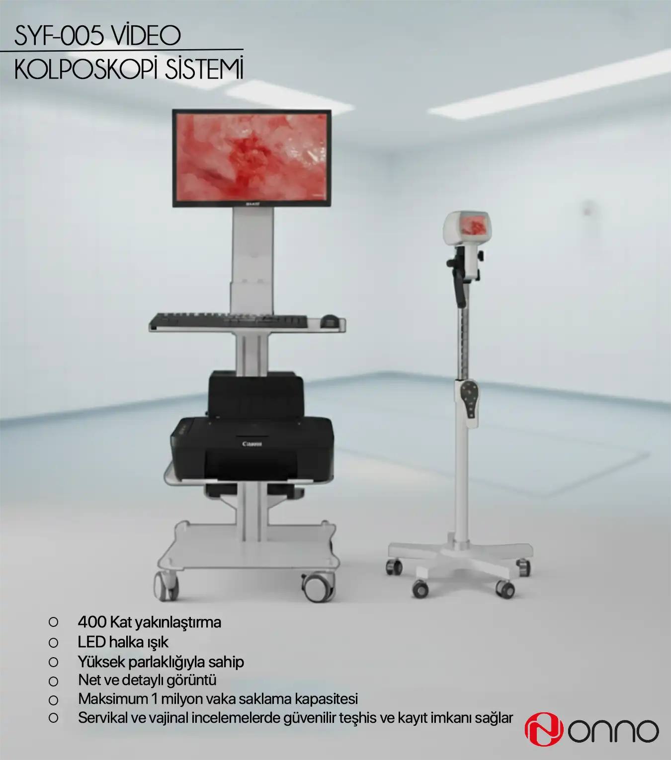  Onno Sy F-005 Video Kolposkop